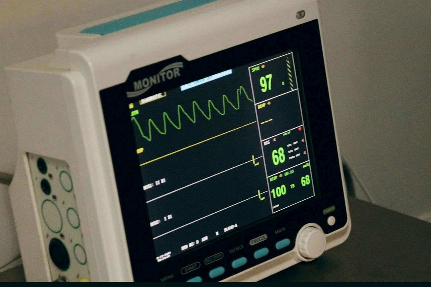 A bedside patient monitor showing a green waveform and vital-sign readings